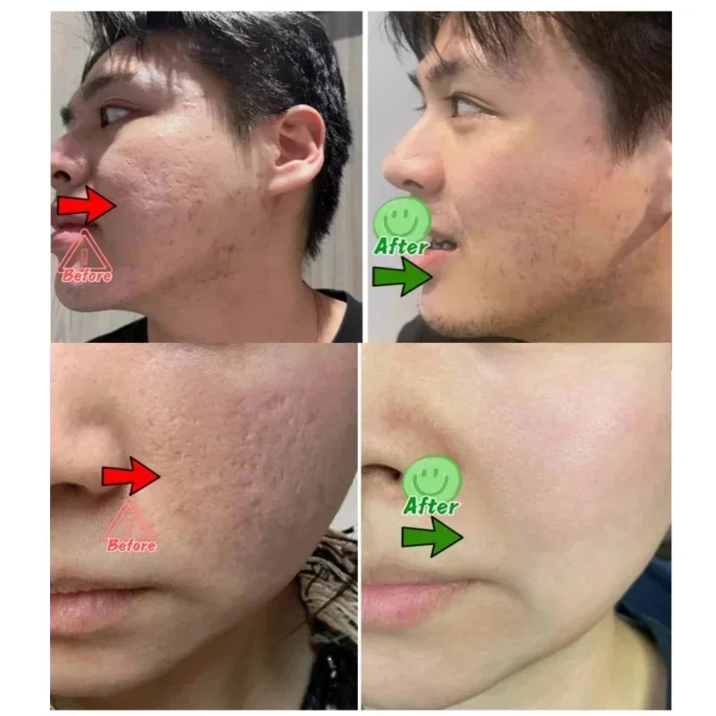 Salisilik Asit Gözenek Temizle - Korean Skincare Routine incelemesi ve fiyatı